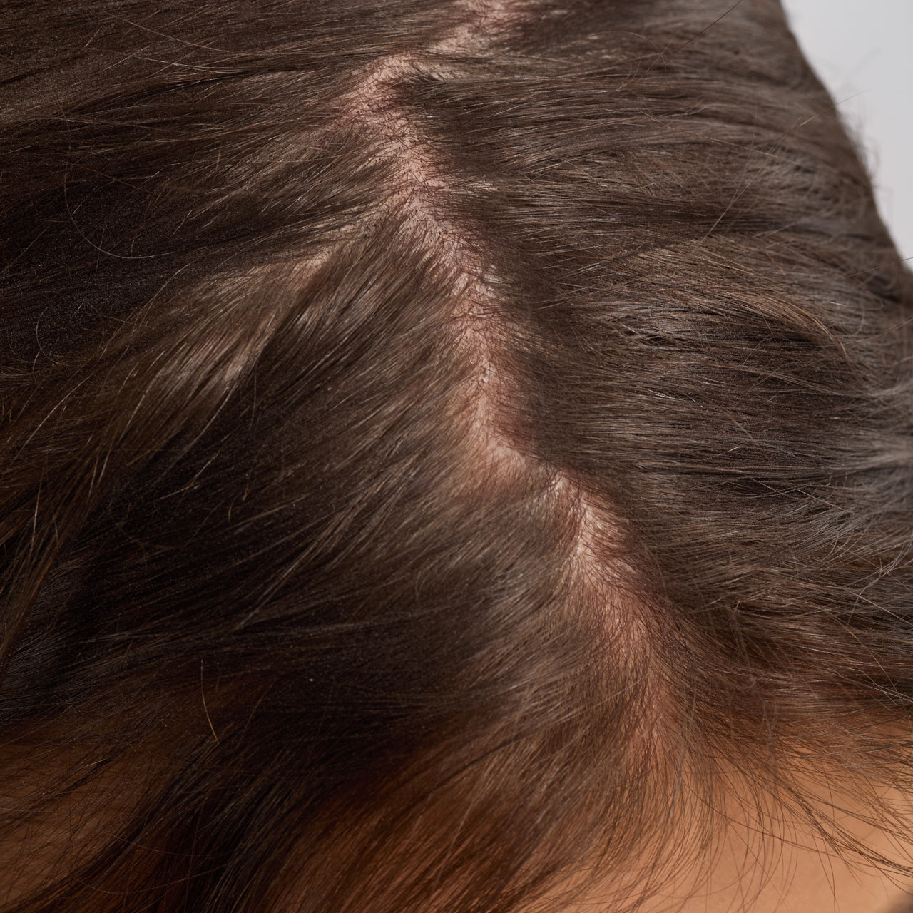 Before image: scalp and hair before using KITSCH Scalp & Hair Oil Applicator with Rosemary & Biotin Scalp Oil — targeted, mess-free scalp oil application routine — part of the R&B Oil 3-Pack